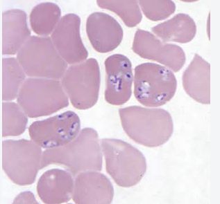Babesia all’interno degli eritrociti in campo chiaro
