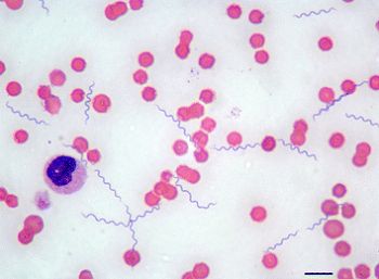 Spirochete di Borrelia osservate in campo chiaro