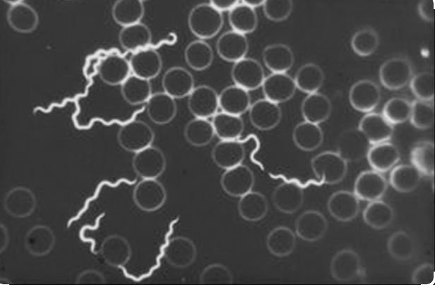 Spirochete di Borrelia osservate in campo oscuro