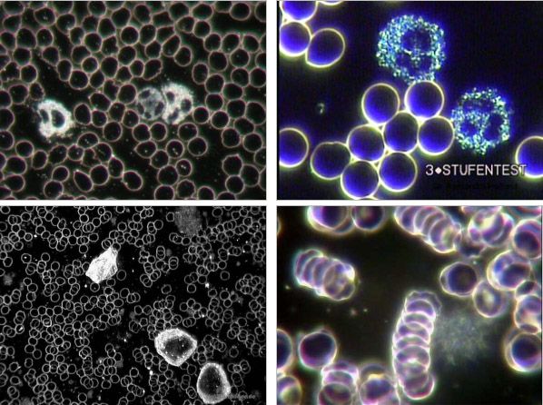 Quattro campi di osservazione del sangue vivo in campo oscuro