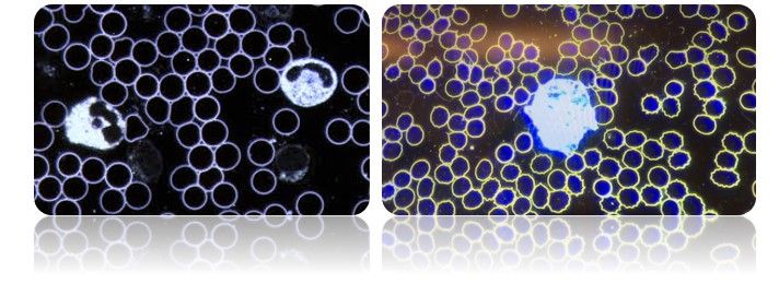 Due campi di sangue vivo con leucociti in evidenza