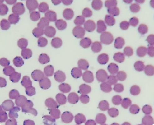 Mycoplasma osservato in campo chiaro