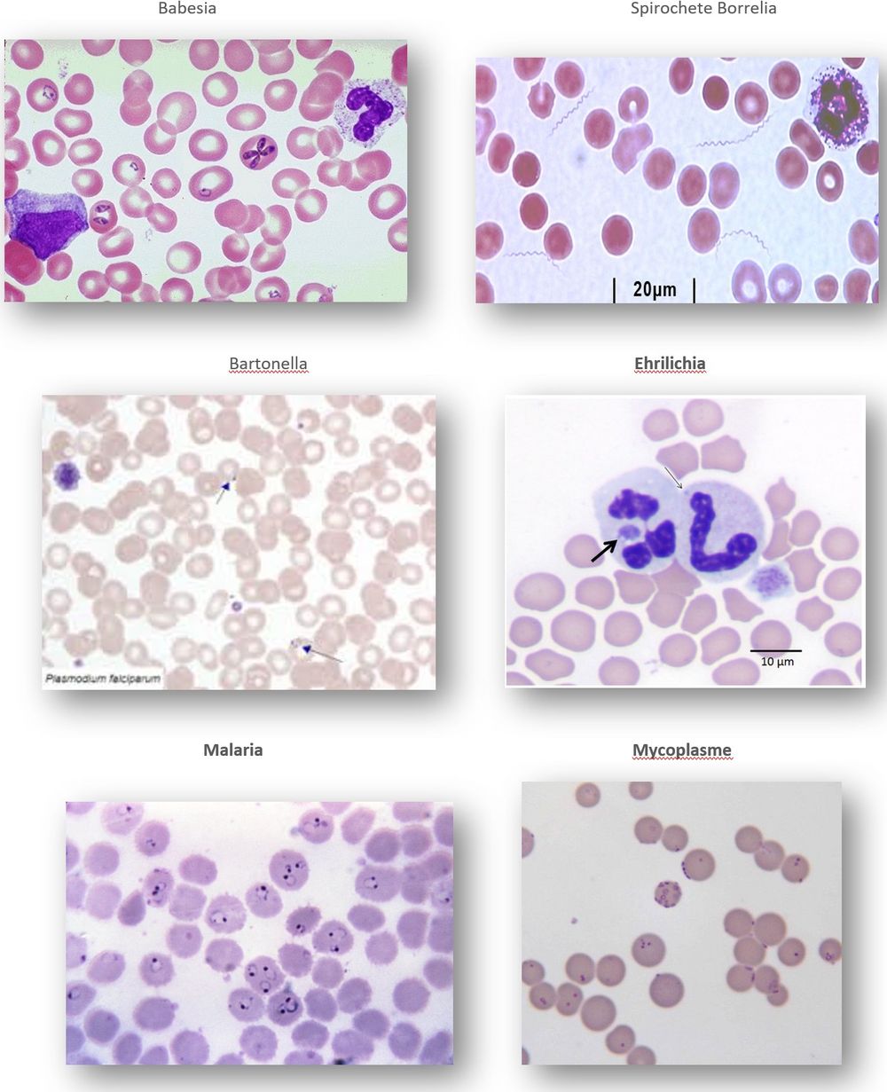 Sei preparati al microscopio con Babesia, spirochete di Borrelia, Bartonella, Ehrlichia, Malaria e Mycoplasma