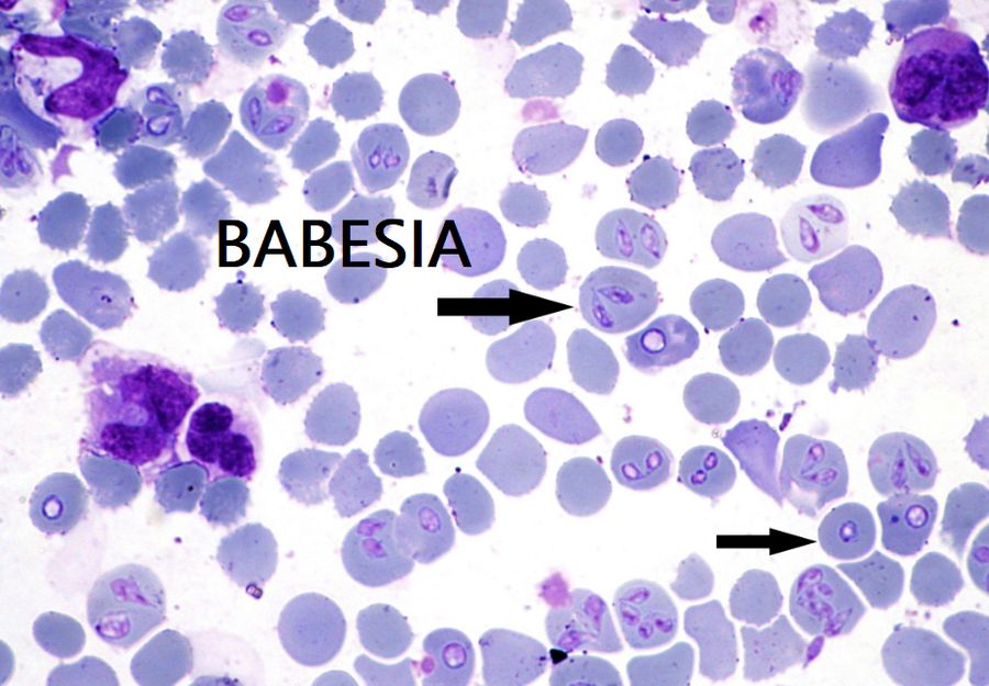 Babesia all’interno degli eritrociti