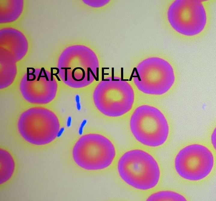 Bartonella in campo chiaro