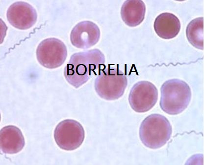 Spirochete di Borrelia in campo chiaro