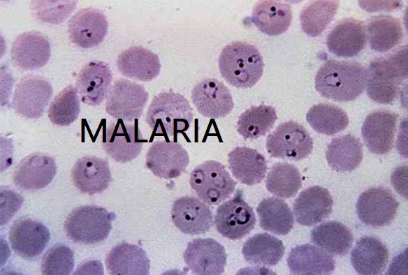 Plasmodio della malaria in campo chiaro