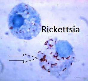Rickettsie in campo chiaro