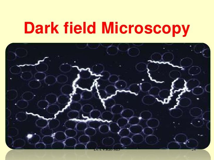 Spirochete di Borrelia visibili fra gli eritrociti in campo oscuro